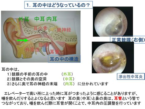 穴汁|耳だれがある・中耳炎のお悩みは尼崎市のほんじょう。